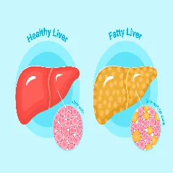 Fairpharma's Ayurvedic Medicine for Fatty Liver: A Natural Solution